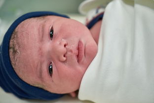 孕妇妊娠合并新生儿代谢性酸中毒怎么碳酸氢钠纠正？